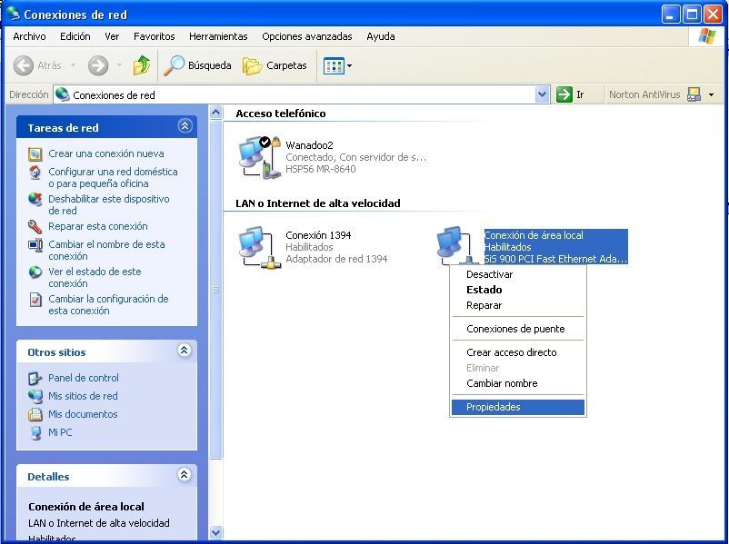 Duplicar Aburrir Tesoro Configurar una Red de Área Local (LAN) en Windows XP | Aleben